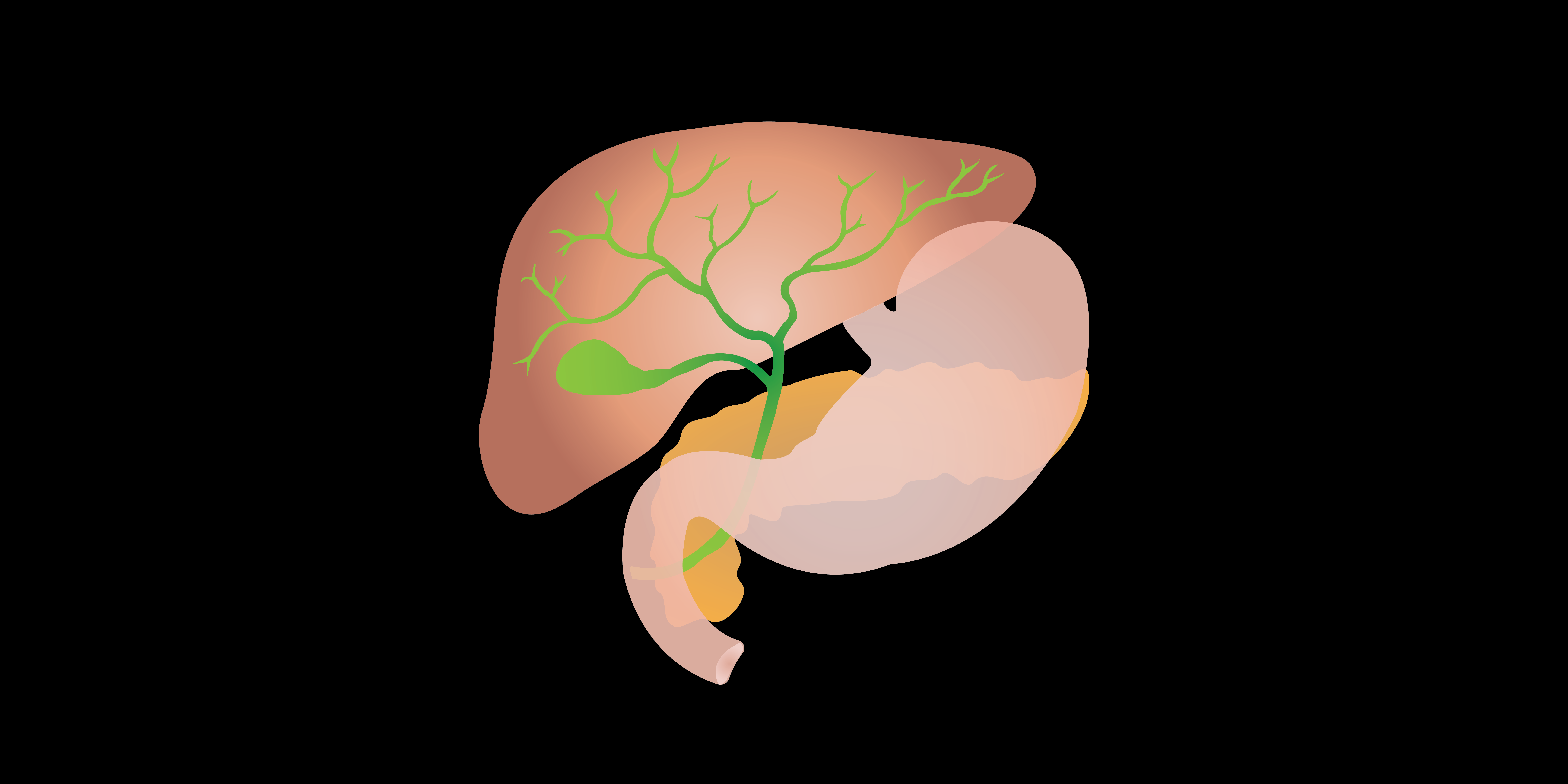 laparoscopic-cholecystectomy-surgery-101