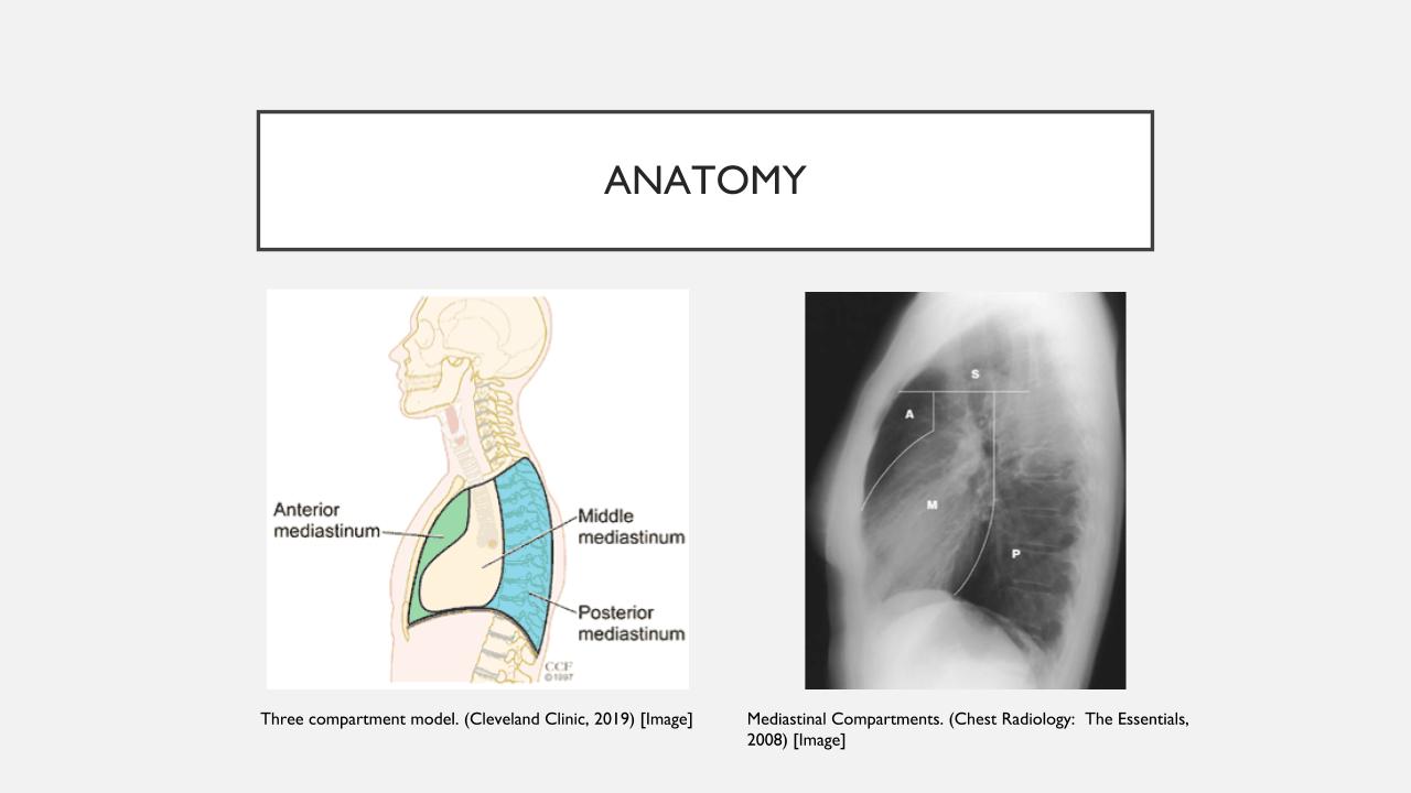 mediastinal-masses-surgery-101