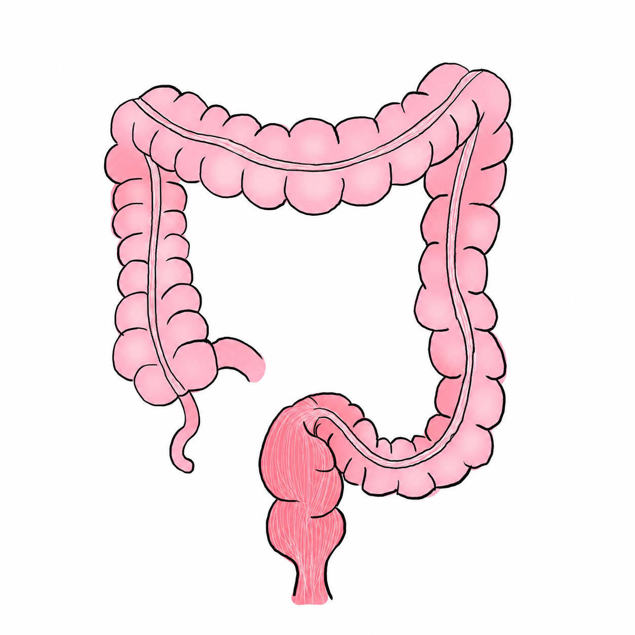 Surgical Management of Colorectal Cancer – Part 1